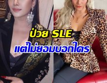 เธอคนนี้พูดแล้ว! สาเหตุไม่บอก แม่-พี่ชายพระเอก ว่าป่วย SLE
