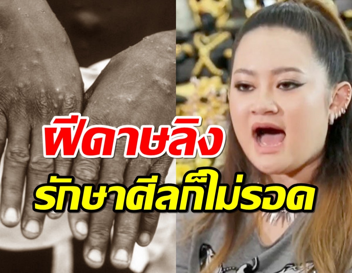 “หมอปลาย” เผยคำทำนาย โรคระบาด ฝีดาษลิง รักษาศีลก็ไม่รอด